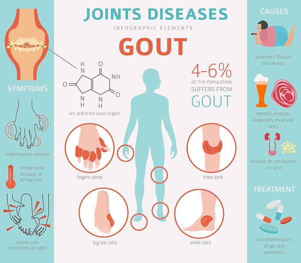 Sauna for Gout Relief: Myths vs. Facts You Need to Know