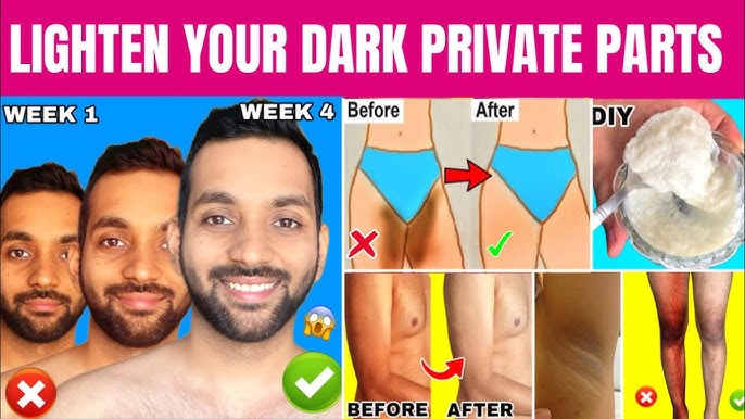 How to Lighten Skin Near Private Parts: Safe and Natural Methods