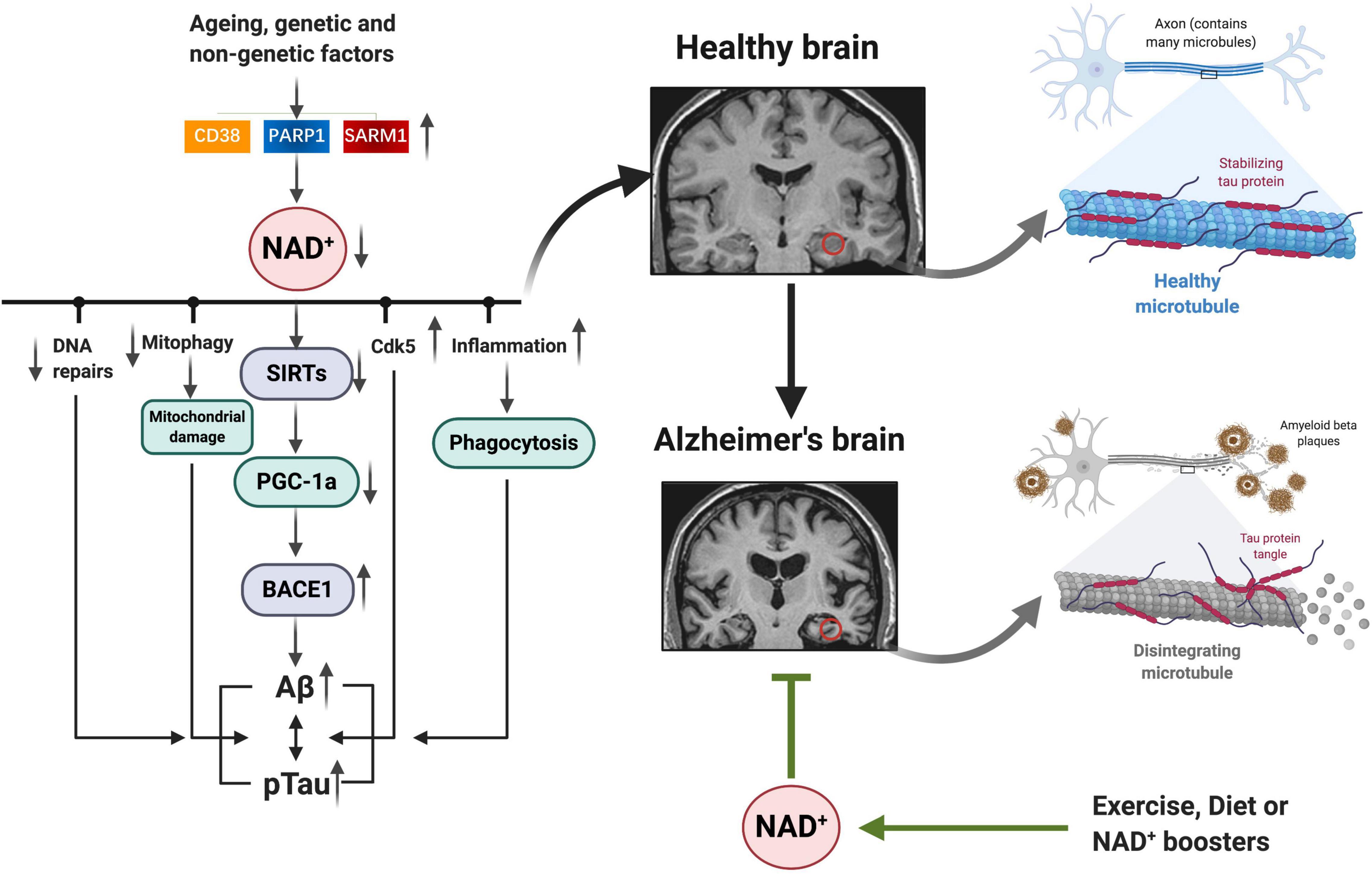 Real NAD+ and Its Role in Alzheimer's Disease and Age-Related Disorders