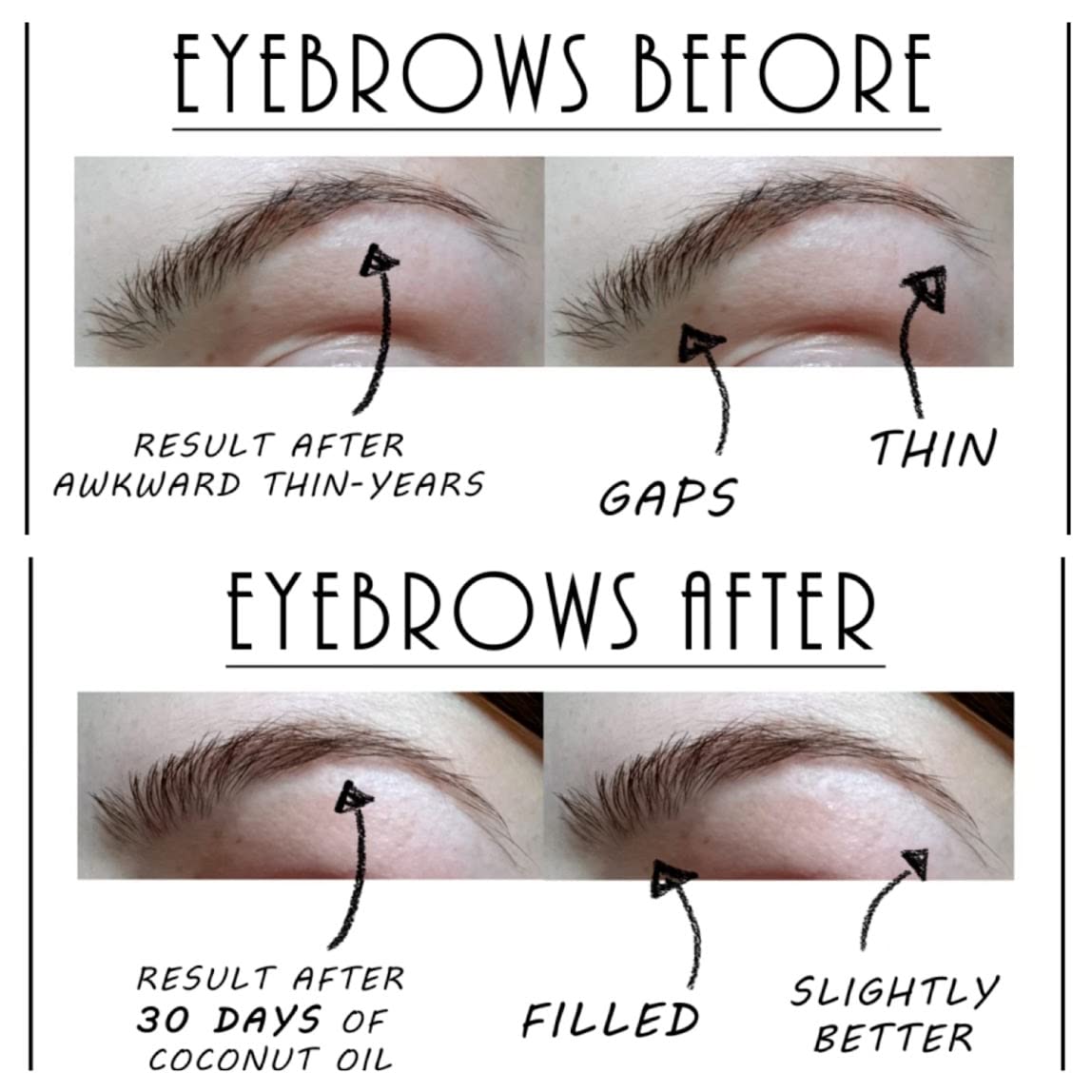 Coconut Oil for Eyebrows: Boost Growth and Fullness Fast