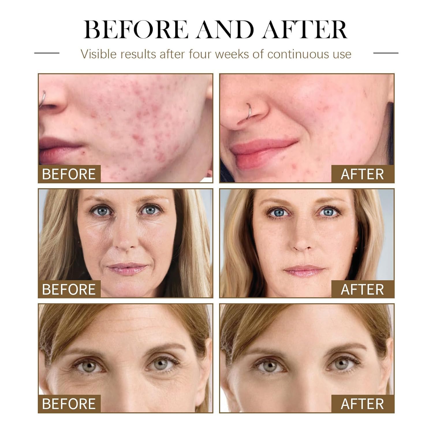 is black castor oil good for wrinkles