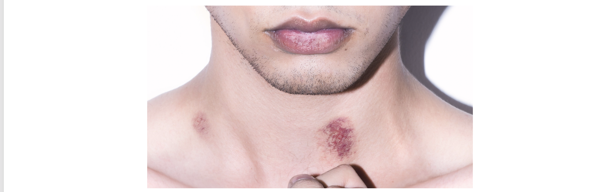 Hickeys at Work: What Your Boss Might Think